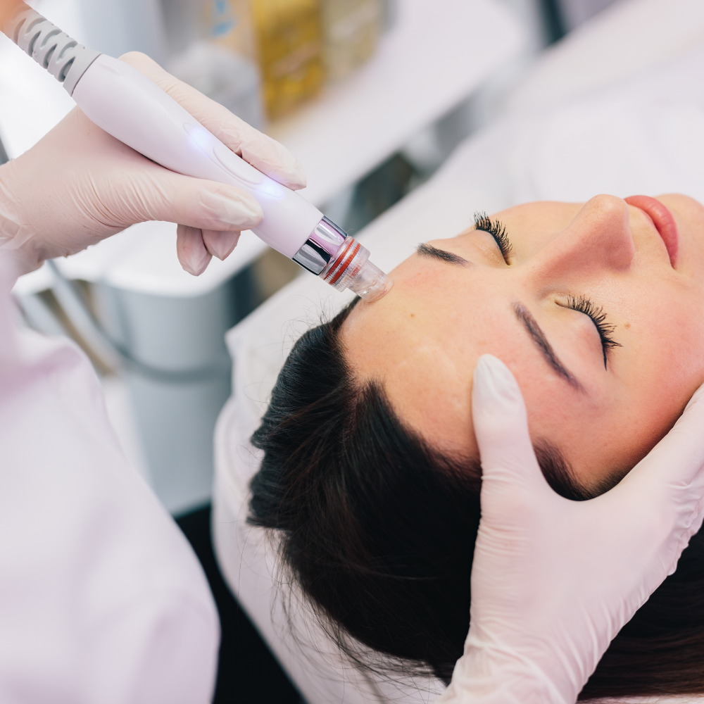 Hydrodermabrasion facial using HydraFacial techniques